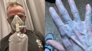 Ξύπνησε όλος μπλε, πήγε στο νοσοκομείο και μόλις τον είδαν οι γιατροί στα επείγοντα πέθαναν στα γέλια