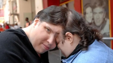 Το μυστικό που κράτησε σιαμαίος δίδυμος από την αδελφή του για δεκαετίες