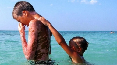 Τα 23.000 παιδιά του Τσερνόμπιλ που βρήκαν θεραπεία στην Κούβα: Η άγνωστη ανθρωπιστική αποστολή