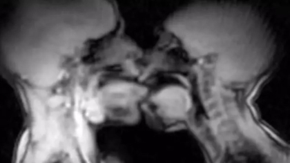 Έκαναν σεξ μέσα σε μαγνητικό τομογράφο και κατέληξαν σε επιστημονική ανακάλυψη!